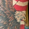 Right arm After 