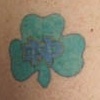 Right arm Before