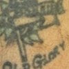 Right arm Before 