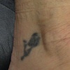 Danielle ankle before
