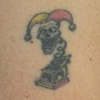 Right arm Before 