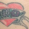 Thigh Before