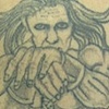 Right arm Before