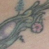 Hip Before 