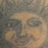 Right arm Before 