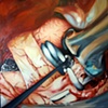 Surgical Commissions