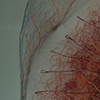 hot sting detail