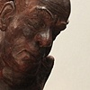 Goiter Study