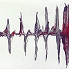 Lifeline